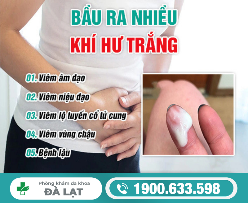 Hình ảnh minh họa